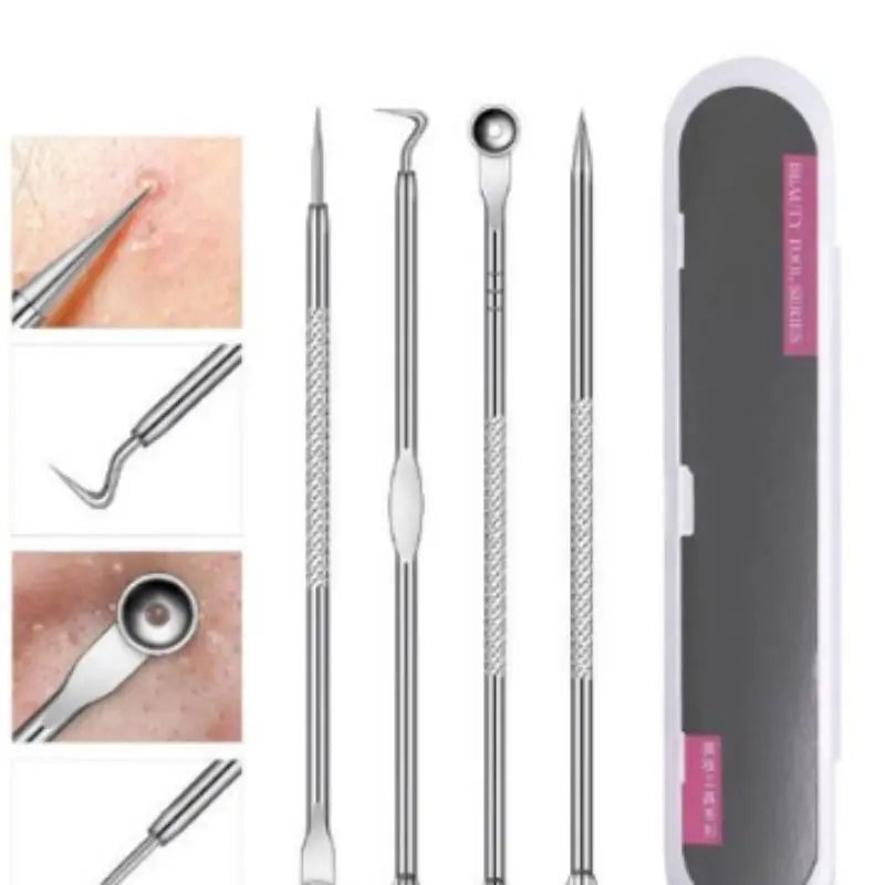 Kit Profissional Extrator de Cravos e Espinhas 4 Peças com Pinça, Agulhas Duplas e Estojo